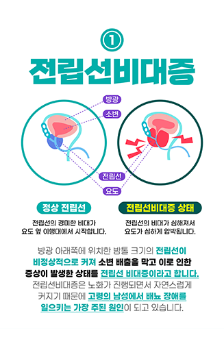 블로그포스팅